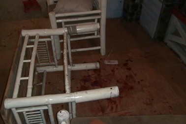 Che chắn cho bạn gái, nam thanh niên bị chém