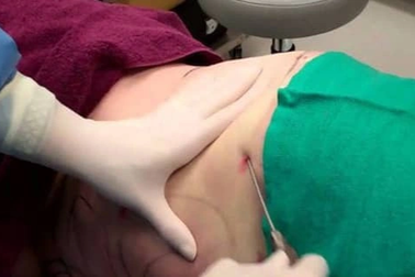 Truy tố 3 bị can trong vụ cô gái tử vong sau khi hút mỡ bụng