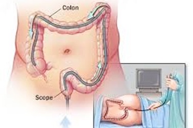 Lời khuyên cho bệnh nhân chuẩn bị mổ nội soi đại trực tràng