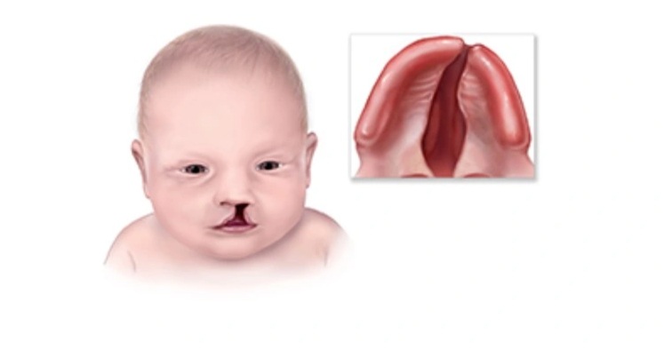 Chủ động bảo vệ con từ tuần thai thứ 10 với xét nghiệm NIPT tại DIAG - 1
