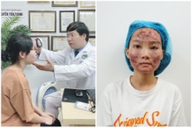 Bôi chất màu đen trị mụn ở spa, nữ sinh Hà Nội "nát bươm" mặt