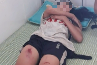 Xe đạp điện lao xuống suối, 3 học sinh thương vong