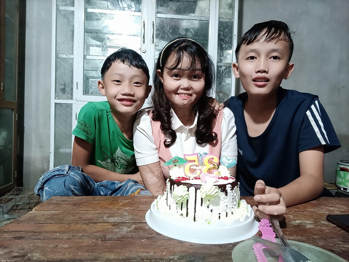 Người phụ nữ hồi sinh cuộc đời sau gần 3 năm bị chồng thiêu sống - 2 Người phụ nữ hồi sinh cuộc đời sau gần 3 năm bị chồng thiêu sống - 2