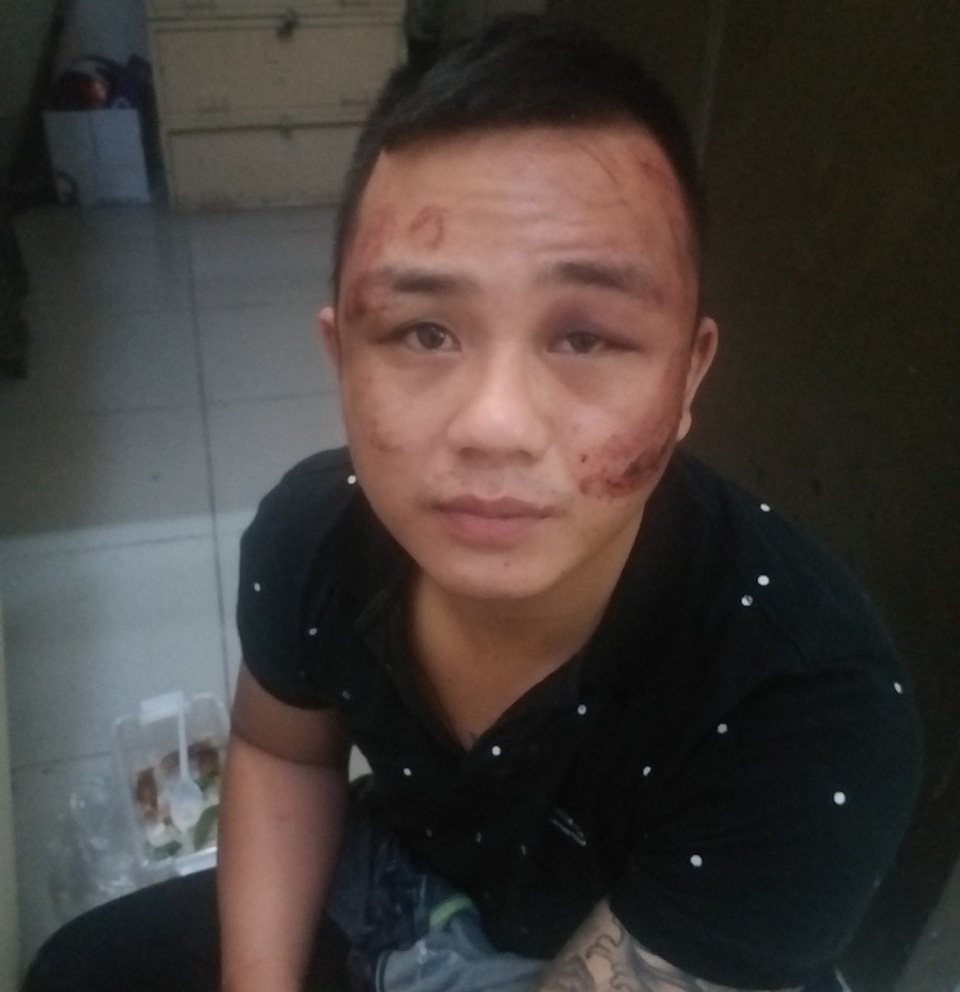 2 tên trộm dùng súng chống trả công an khi bị truy bắt - 1 2 tên trộm dùng súng chống trả công an khi bị truy bắt - 1