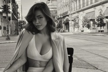 Người mẫu lai Việt - Trung nóng bỏng tự hào về vết sẹo bỏng trên cơ thể