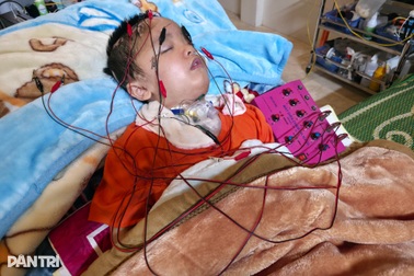 Con trai 8 tuổi thoi thóp sau tai nạn, bố mẹ kiệt sức níu giữ mạng sống
