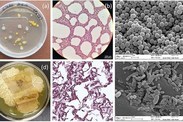 Vi khuẩn bảo vệ tranh cổ khỏi các vi khuẩn ăn sắc tố