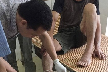 Không may bị máy cắt cỏ cắt đứt lìa bàn chân