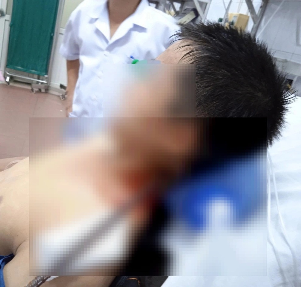 Cứu sống nam thanh niên bị thanh sắt đâm xuyên từ cổ qua não - 1 Cứu sống nam thanh niên bị thanh sắt đâm xuyên từ cổ qua não - 1
