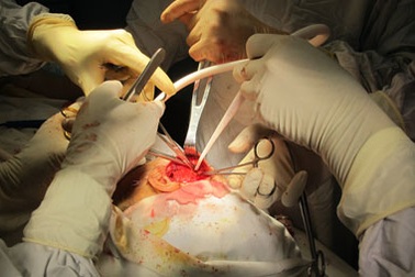 “Giải cứu” hàm răng bị dính chặt suốt 30 năm