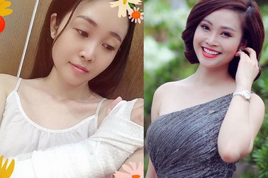 MC sở hữu "nụ cười đẹp nhất" VTV gặp tai nạn gãy tay