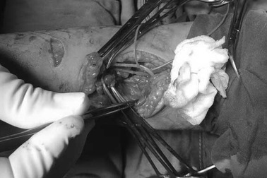 Rơi từ tầng 7, bé 4 tuổi thoát chết kỳ diệu