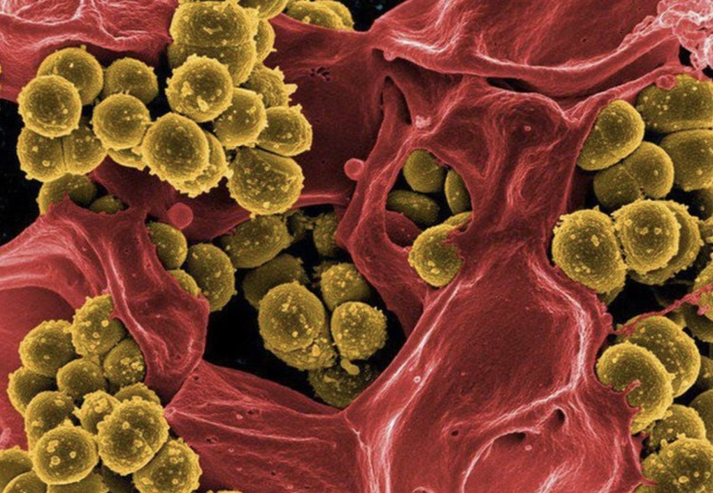 Trai trẻ rước họa vào thân vì tìm cách “tăng khoái cảm” phản khoa học - 1 Trai trẻ rước họa vào thân vì tìm cách “tăng khoái cảm” phản khoa học - 1