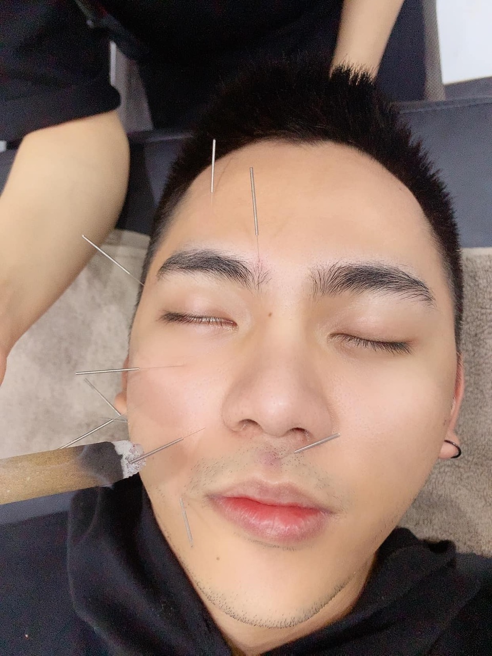 Lời cảnh tỉnh của chàng Youtuber sau hành trình chữa trúng gió méo miệng - 6 Lời cảnh tỉnh của chàng Youtuber sau hành trình chữa trúng gió méo miệng - 6