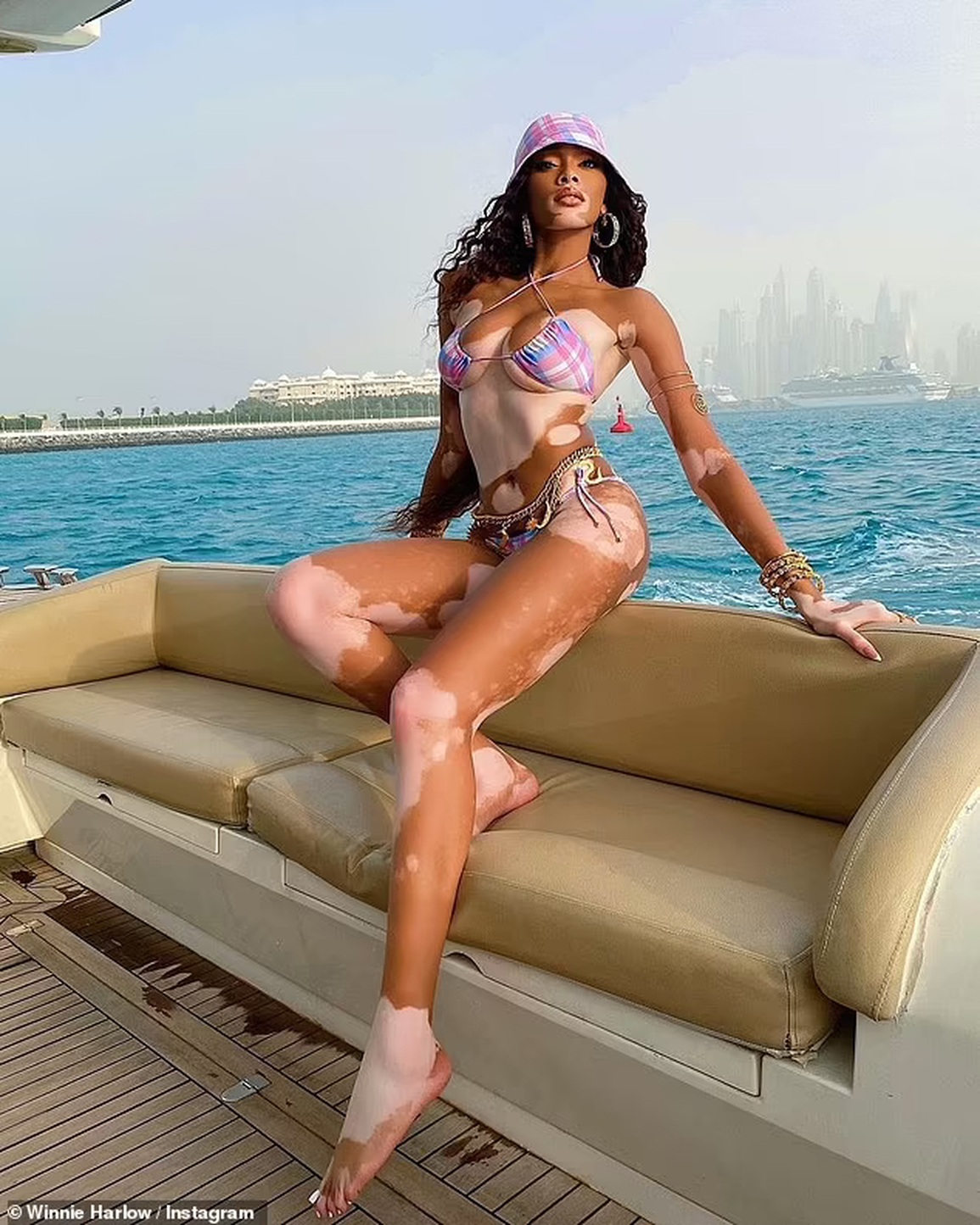 Siêu mẫu bạch biến Winnie Harlow khoe chân thon trong kỳ nghỉ tại Dubai - 1 Siêu mẫu bạch biến Winnie Harlow khoe chân thon trong kỳ nghỉ tại Dubai - 1