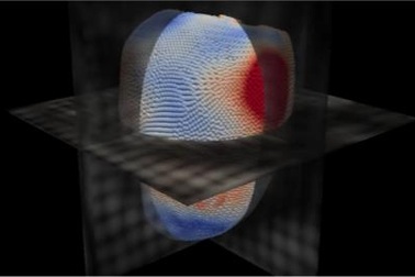 Trí tuệ nhân tạo có thể giúp dự đoán suy tim