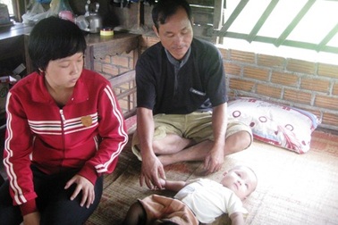 Bé 2 tuổi mơ tìm lại ánh sáng cho đôi mắt