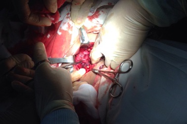 Huyện đảo Bạch Long Vĩ huy động Thanh niên xung phong hiến máu cứu sống ngư dân