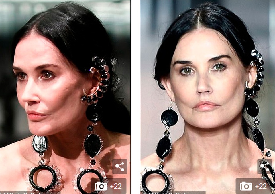 Lộ mặt sưng phồng kỳ dị, Demi Moore bị nghi phẫu thuật thẩm mỹ - 1 Lộ mặt sưng phồng kỳ dị, Demi Moore bị nghi phẫu thuật thẩm mỹ - 1