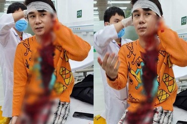 Hà Nội: Diễn viên phim "Thương ngày nắng về" bị chém trên phố Xã Đàn