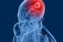 U lành tính có tái phát không?