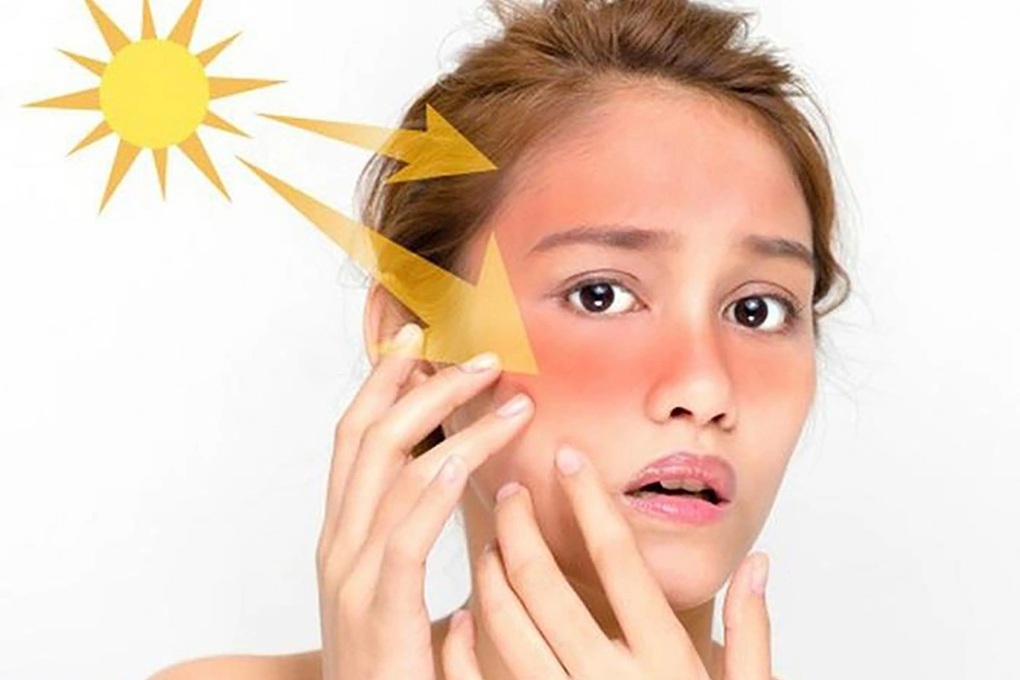 Thu hồi kem chống nắng kém chất lượng, chỉ số chống nắng có như không - 1 Thu hồi kem chống nắng kém chất lượng, chỉ số chống nắng có như không - 1