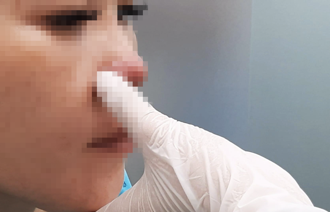 Thêm cô gái TPHCM gánh hậu quả nặng nề sau 3 ngày làm đẹp ở spa - 1 Thêm cô gái TPHCM gánh hậu quả nặng nề sau 3 ngày làm đẹp ở spa - 1