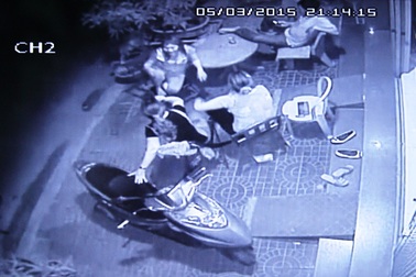 Ngồi hóng mát trước nhà, chủ doanh nghiệp bị tạt axít vào mặt