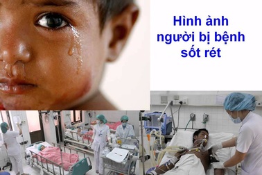 Hơn 10 tỉnh gia tăng người mắc sốt rét, dịch có thể quay trở lại?