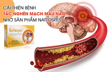 Cải thiện bệnh tắc nghẽn mạch máu não nhờ sản phẩm Nattospes