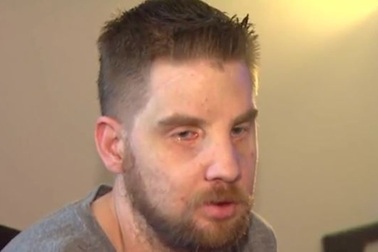 Người đàn ông ghép mặt kể câu chuyện cuộc đời sau 5 năm cấy ghép