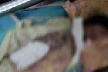 Cụ bà 97 tuổi tử vong bất thường với nhiều vết bầm tím trên người