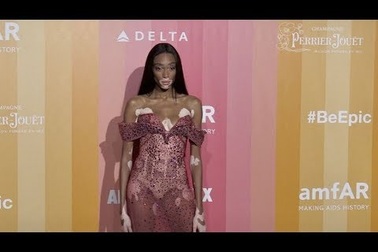 Winnie Harlow gợi cảm dự tiệc