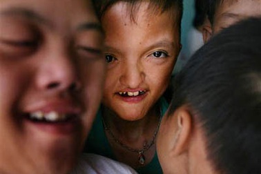 Nạn nhân da cam Việt Nam kêu gọi quốc tế ủng hộ 