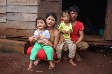 Đáng thương 2 anh em cùng mắc bệnh "suy tim, khiếm thị, hở hàm ếch"