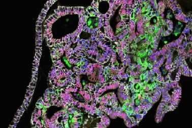 Các nhà khoa học chế tạo thành công mô dạ dày của người trong phòng thí nghiệm