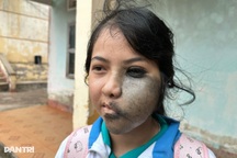 Nỗi đau ẩn phía sau lớp khẩu trang của nữ sinh mồ côi mẹ