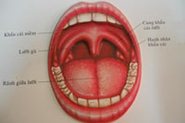Viêm amiđan: Khi nào nên phẫu thuật?