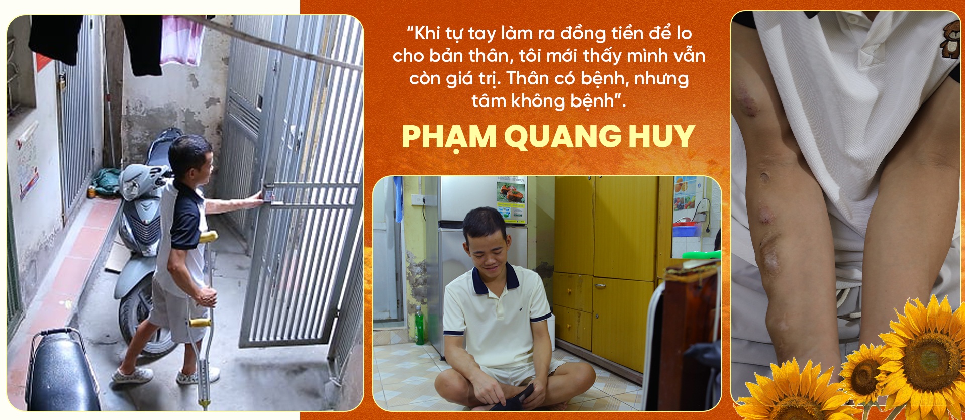 9X suy thận chống nạng làm TikTok, 8 năm cãi số từ phòng trọ 4m2 - 15 9X suy thận chống nạng làm TikTok, 8 năm cãi số từ phòng trọ 4m2 - 15