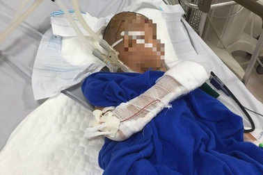 Kẻ “ngáo đá” dùng dao chém liên tiếp vào đầu bé trai 9 tuổi