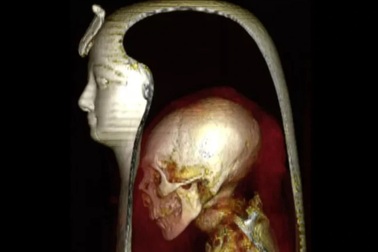 Chụp CT vị Pharaoh nổi tiếng, các nhà khoa học phát hiện điều bất thường
