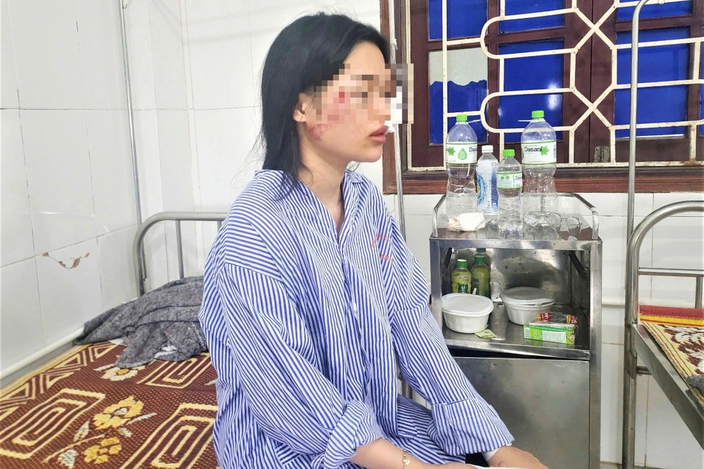 Vụ lật xe khách ở Hà Tĩnh: Kính xe vỡ vụn, nhiều người bị hất văng ra ngoài - 1 Vụ lật xe khách ở Hà Tĩnh: Kính xe vỡ vụn, nhiều người bị hất văng ra ngoài - 1