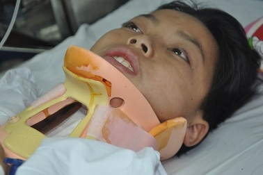 Ngã khi trèo hái me, cậu bé lớp 10 nguy kịch