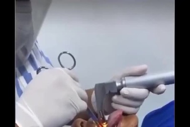 Gắp cá sống 18 cm ra khỏi cổ họng bệnh nhân