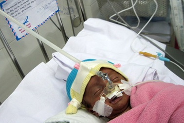 Bé sinh non thoi thóp thở và chiếc phong thư bí ẩn