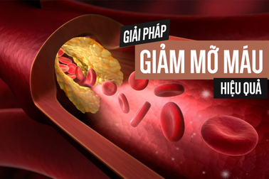 Biểu hiện, nguyên nhân bệnh mỡ máu cao và cách xử lý của người Nhật