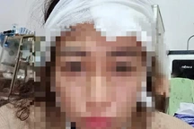 Cô gái kể bố cho mẹ "ăn dao cạo", đánh thẳng vùng kín vì dám cắt tóc tém