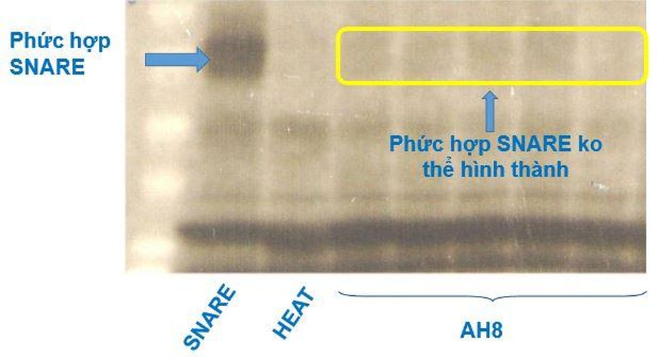 Chuyên gia Đại học Y Hà Nội giới thiệu công nghệ chống nhăn từ giải Nobel - 3 Chuyên gia Đại học Y Hà Nội giới thiệu công nghệ chống nhăn từ giải Nobel - 3