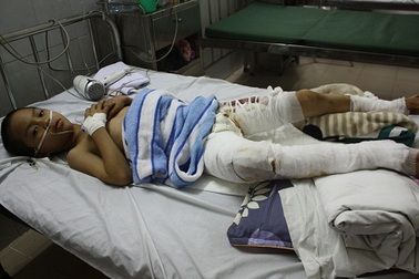 Ngã vào nồi nước sôi làm gà, tính mạng bé 8 tuổi vô cùng nguy kịch