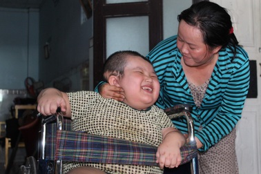 Người mẹ hối hận khi đầu con trai 7 tuổi phình to như trái bóng